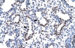 HEY1 Rabbit anti-Human, Polyclonal, Novus Biologicals 100 &mu;g; Unconjugated:Antibodies,